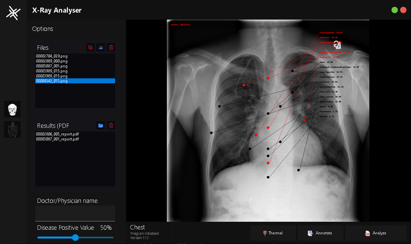 Screenshot of the X-Ray AI prototype interface